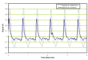 BAM normal time domain waveform